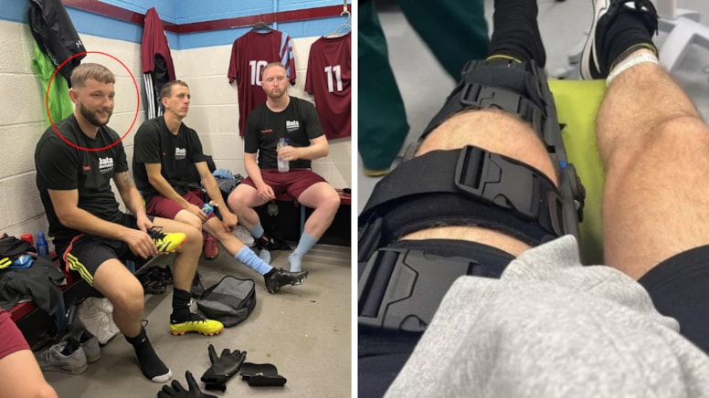  Böyle dehşet görülmedi! Futbolculara beyzbol sopalı saldırı